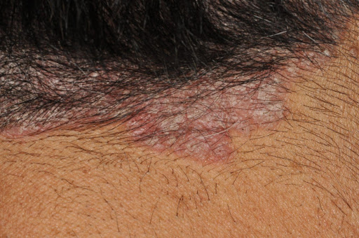 治療と家庭療法