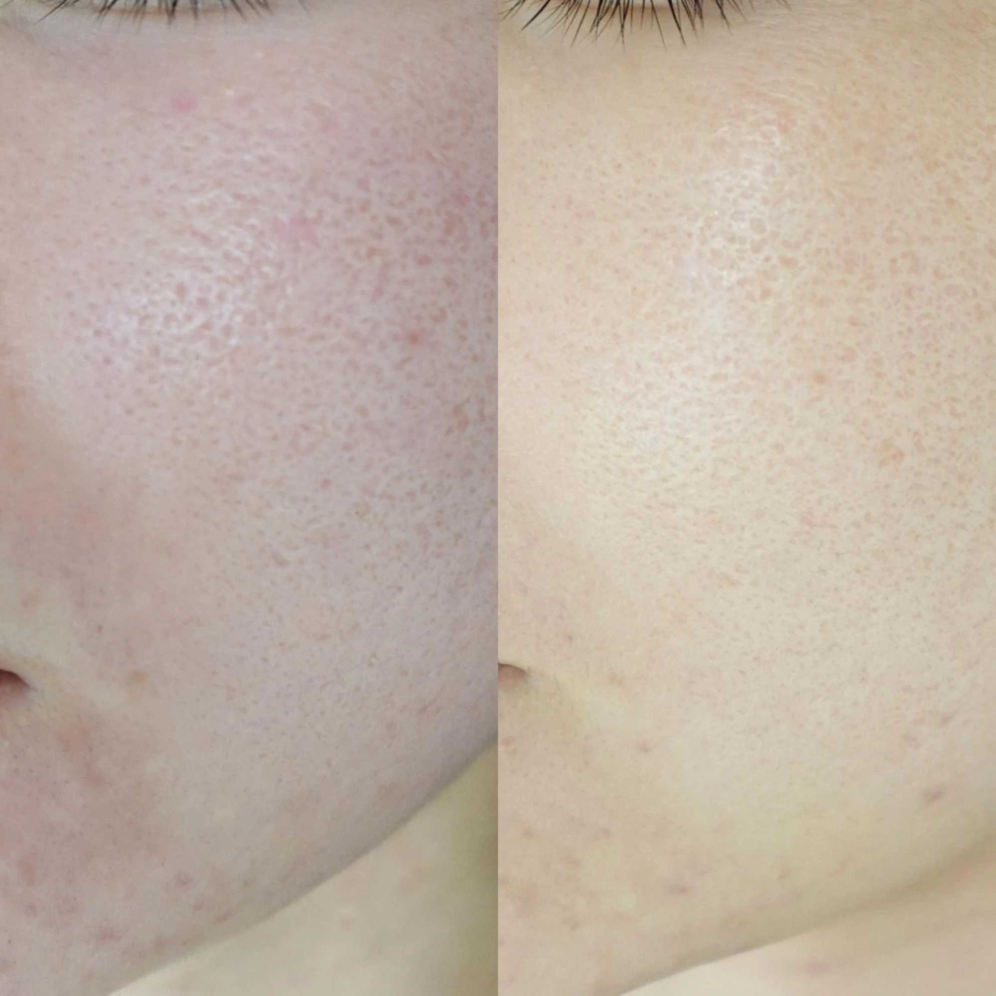 トライフィルプロ画像