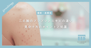 二の腕のブツブツとニキビの違いは何？見分け方のポイントと適切な処置を徹底解説