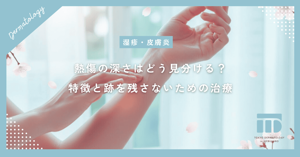 熱傷の深さはどう見分ける？1度から3度熱傷の特徴と跡を残さないための治療選択
