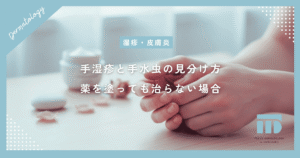 手湿疹と手水虫の見分け方とは？薬を塗っても治らない場合に確認すべきポイントを解説