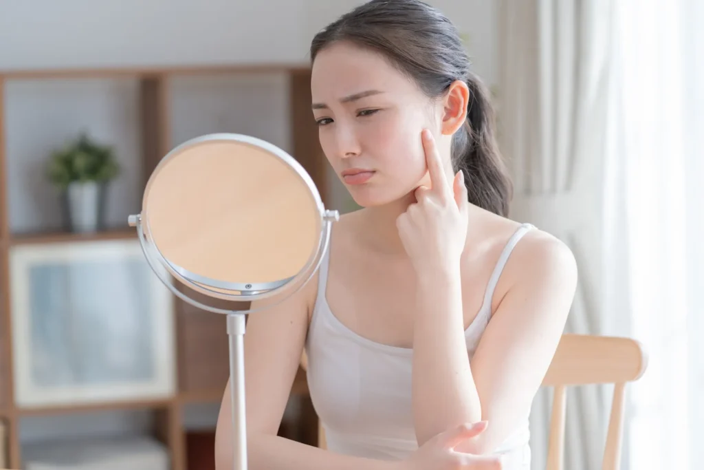 鏡で頬の赤みを気にする女性(赤ら顔のイメージ)