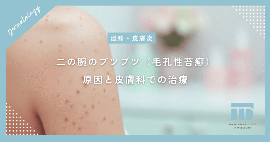 二の腕のブツブツの原因とは？毛孔性苔癬の正体と皮膚科での治し方を詳しく解説
