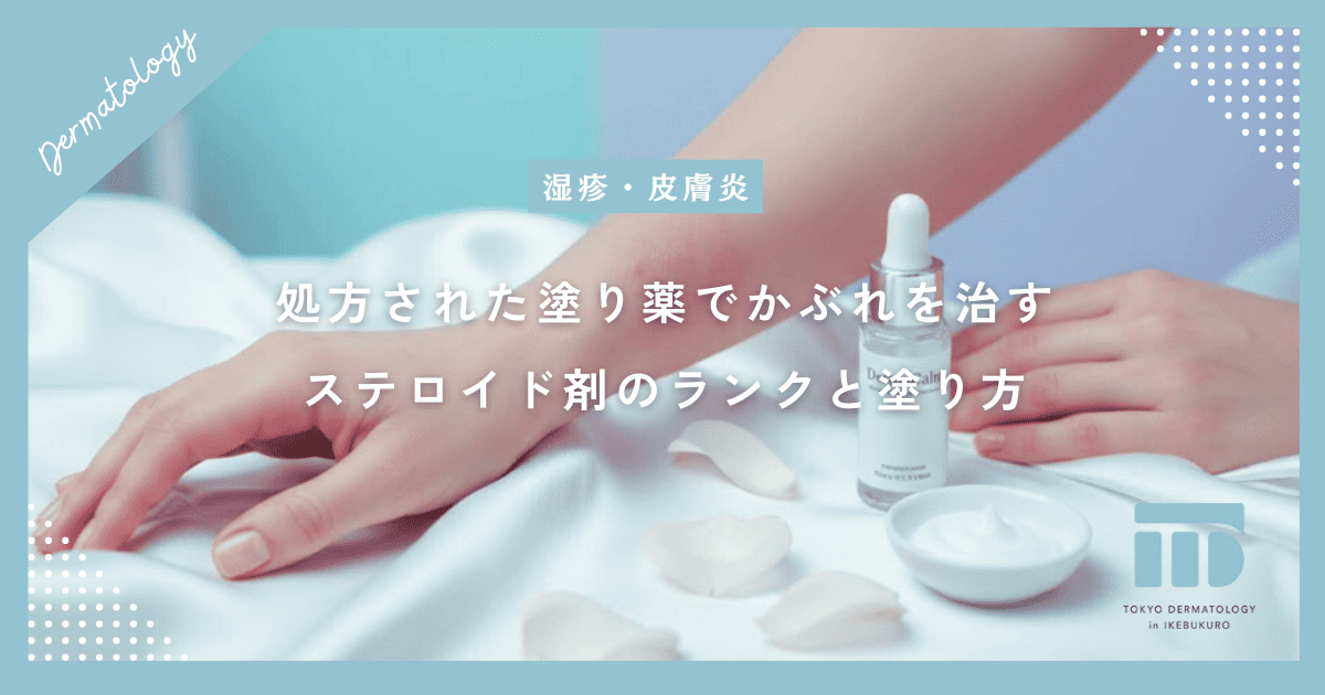処方された塗り薬でかぶれを治す!ステロイド剤のランクと正しい塗り方を伝授
