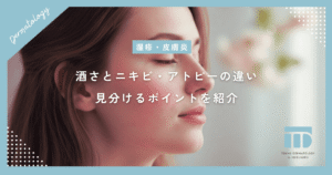酒さとニキビ・アトピーの違いは何？顔の赤みが消えない時に見分けるポイントを紹介