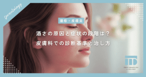 酒さ（赤ら顔）の原因と症状の段階は？皮膚科での診断基準と治し方の基本を解説