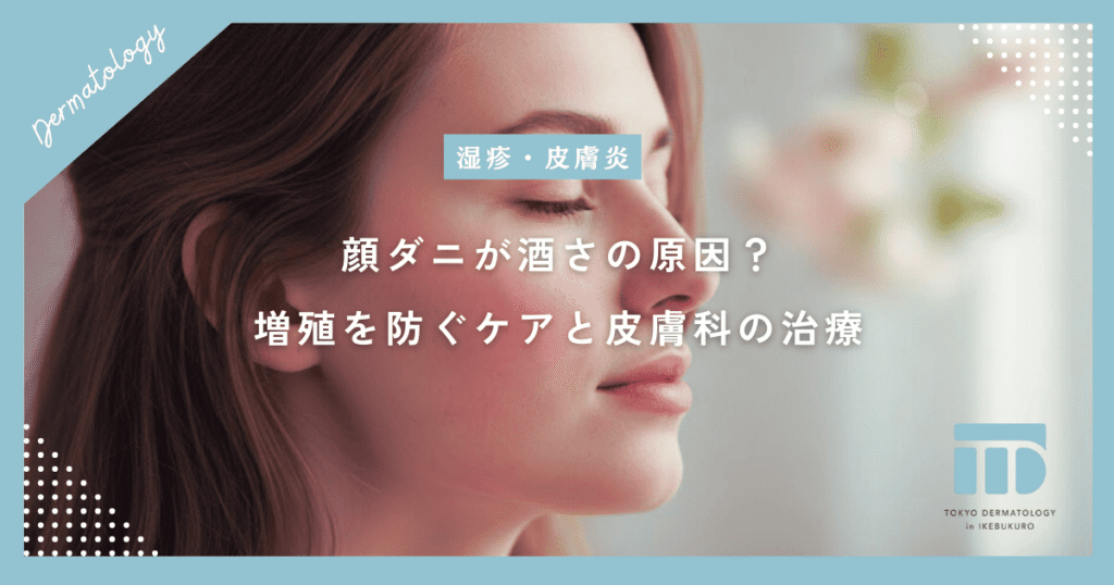 顔ダニ（ニキビダニ）が酒さの原因に？増殖を防ぐための正しいケアと皮膚科の治療