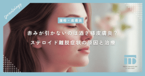 顔の赤みが引かないのは酒さ様皮膚炎？ステロイド離脱症状の原因と治療期間を解説