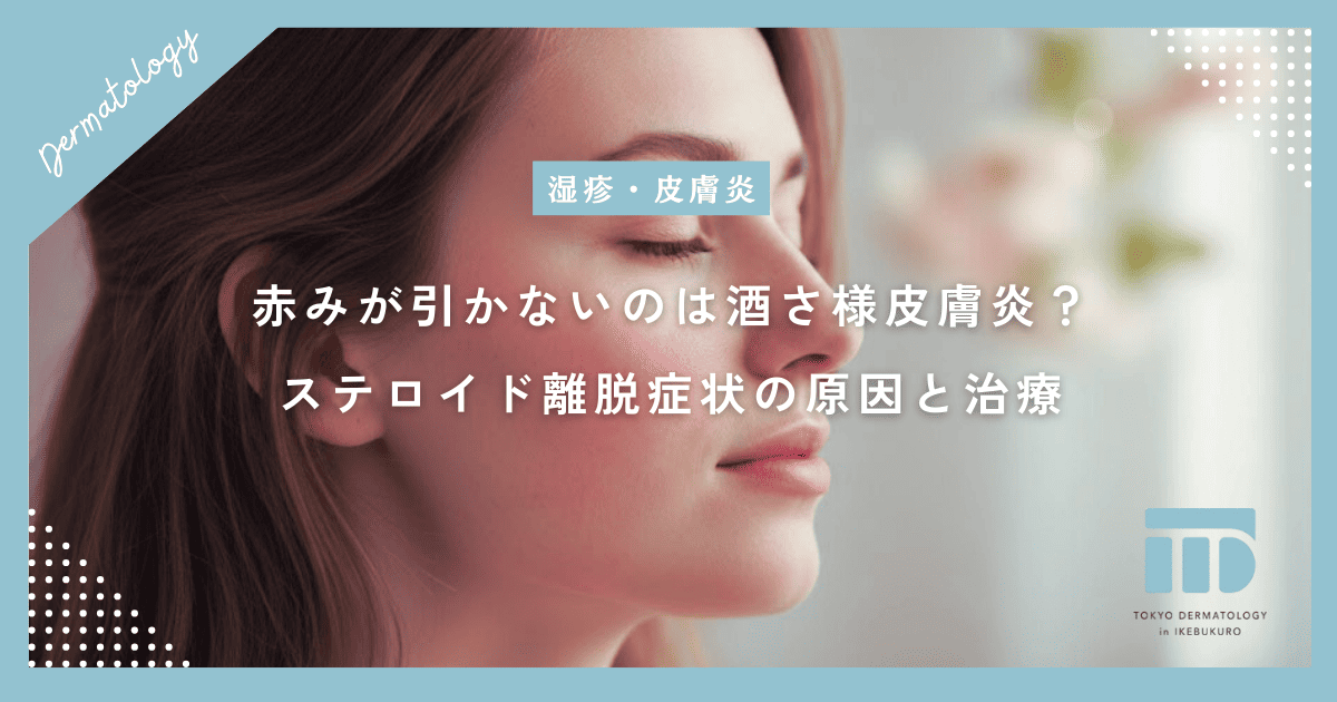 顔の赤みが引かないのは酒さ様皮膚炎？ステロイド離脱症状の原因と治療期間を解説