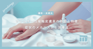 アレルギー性接触皮膚炎の原因と特徴！アレルゲンが起こす症状のメカニズムと治療法