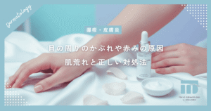 目の周りのかぶれや赤みの原因は？アイメイクや花粉による肌荒れと正しい対処法