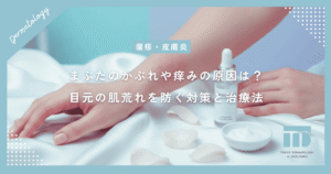 まぶたのかぶれや痒みの原因は？デリケートな目元の肌荒れを防ぐ対策と治療法