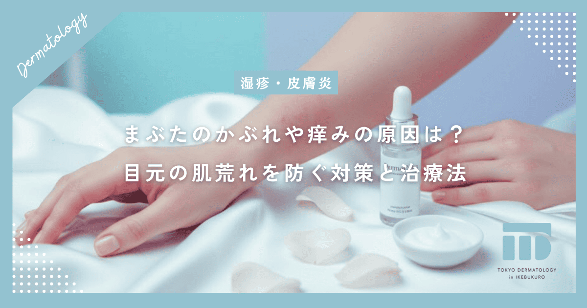 まぶたのかぶれや痒みの原因は？デリケートな目元の肌荒れを防ぐ対策と治療法