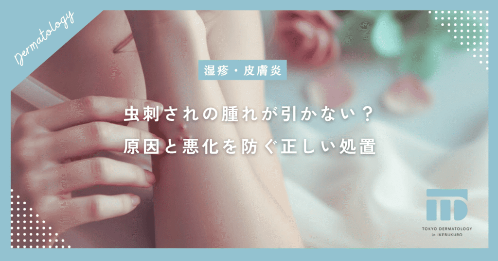 虫刺されの腫れが引かない？長引くかゆみの原因と悪化を防ぐ正しい処置