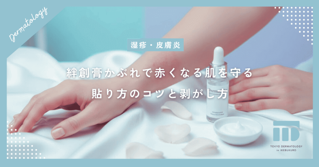 【絆創膏かぶれの原因】テープ負けで赤くなる肌を守る貼り方のコツと剥がし方