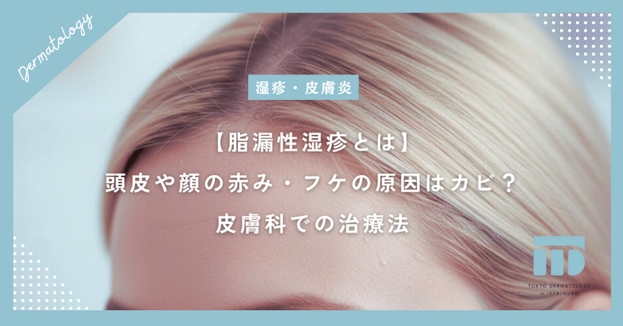【脂漏性湿疹とは】頭皮や顔の赤み・フケの原因はカビ？皮膚科での治療法
