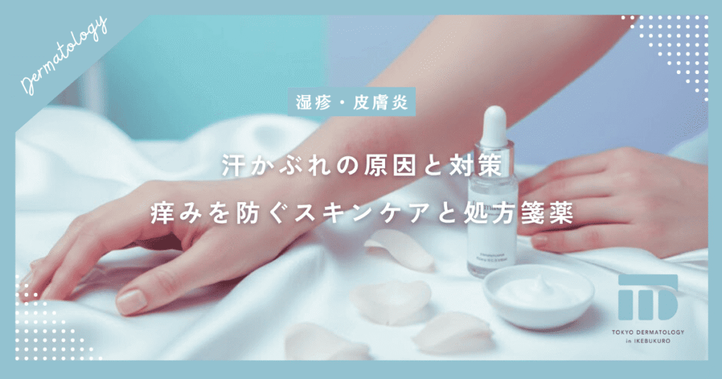 【汗かぶれの原因と対策】チクチクする痒みを防ぐスキンケアと皮膚科での薬