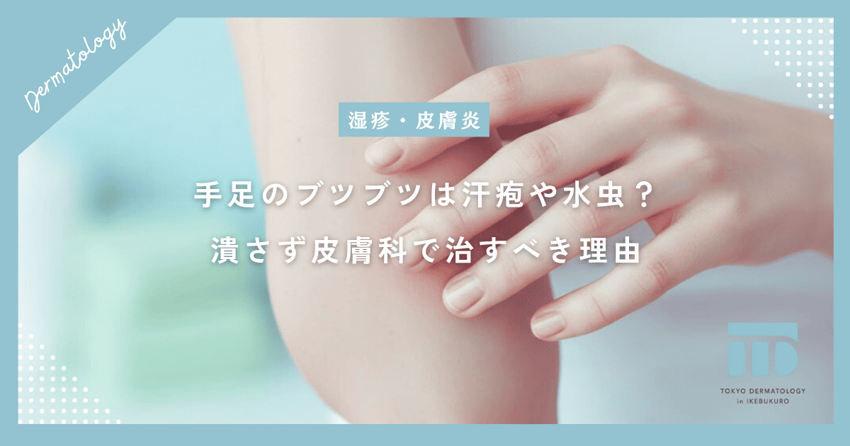 【小さな水ぶくれとかゆみ】手足のブツブツは汗疱や水虫?潰さず皮膚科で治すべき理由