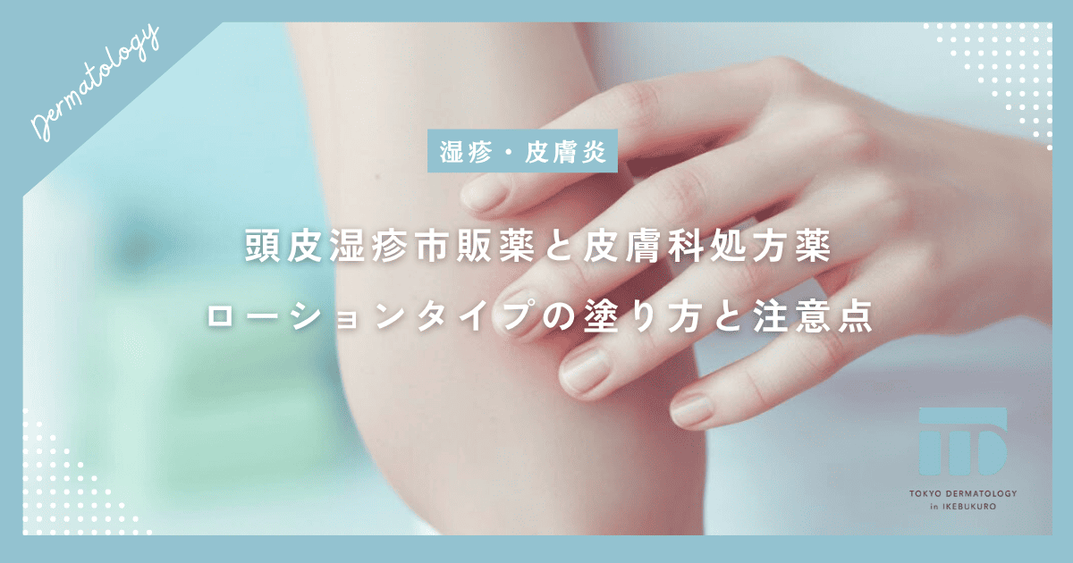 【頭皮湿疹の薬】市販薬と皮膚科処方薬の違いは?ローションタイプの正しい塗り方と注意点