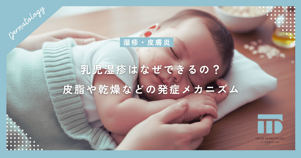 【乳児湿疹の原因】なぜできるの?皮脂の過剰分泌や乾燥など発症のメカニズム