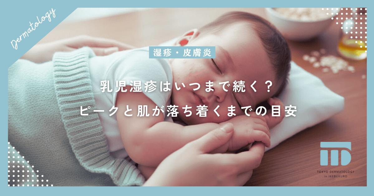 【乳児湿疹はいつまで続く？】ピークの時期と肌が落ち着くまでの経過の目安