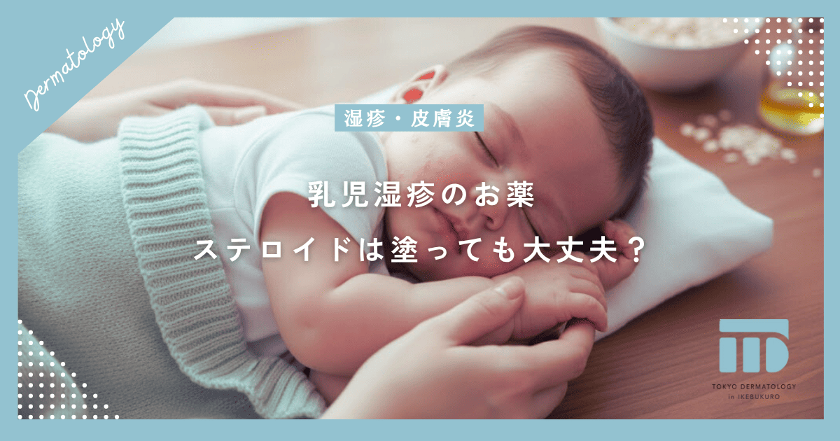 【乳児湿疹の薬】ステロイドは塗っても大丈夫?皮膚科での処方と塗り方のコツ
