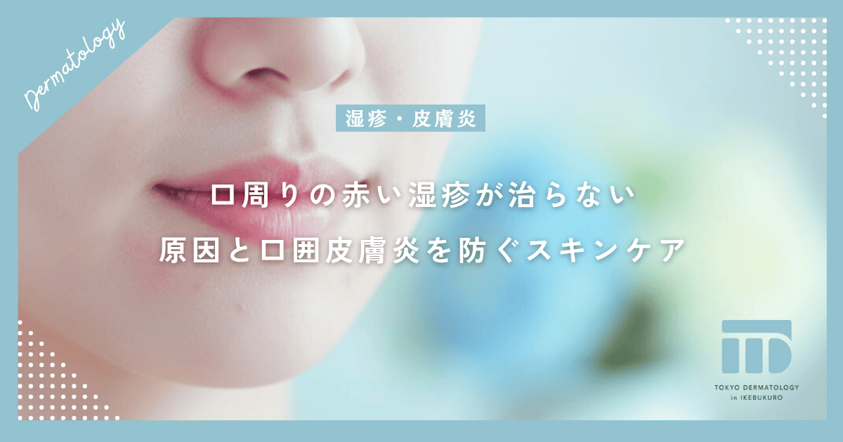 口周りの赤い湿疹が治らない?ヒリヒリやかゆみの原因と口囲皮膚炎を防ぐ正しいスキンケア