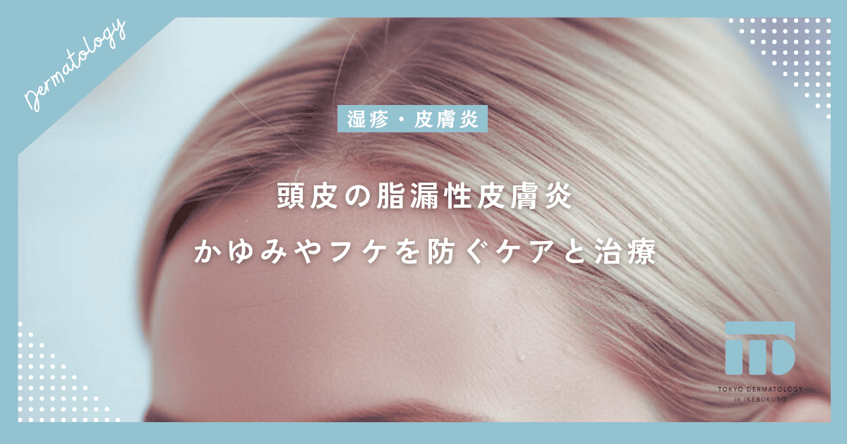 頭皮の脂漏性皮膚炎！かゆみや大量のフケを防ぐ正しいケアと皮膚科での治療
