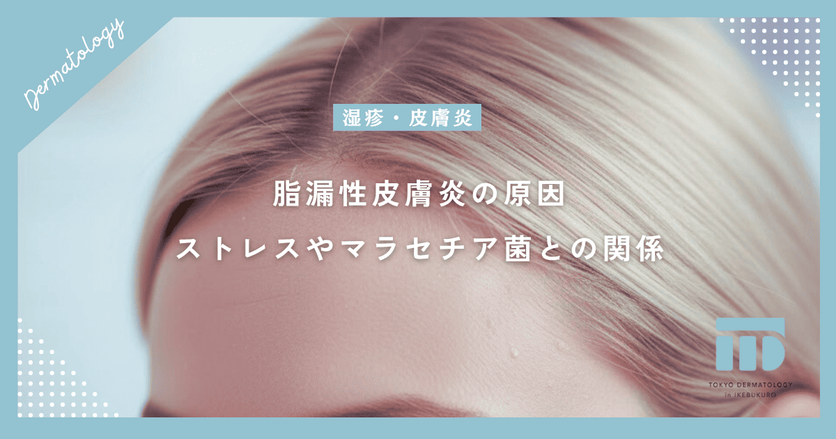 【脂漏性皮膚炎の原因】なぜ皮脂が増える?ストレスやマラセチア菌との関係