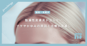 【脂漏性皮膚炎が治らない方へ】繰り返すフケやかゆみの原因と治療の見直し