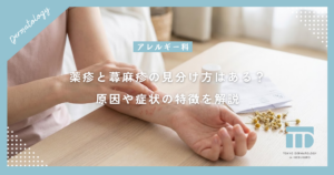 【薬疹と蕁麻疹の違い】見分け方はある？原因や症状の特徴を分かりやすく解説