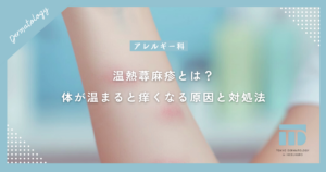 温熱蕁麻疹とは？お風呂上がりや暖房で体が温まると痒くなる原因と対処法
