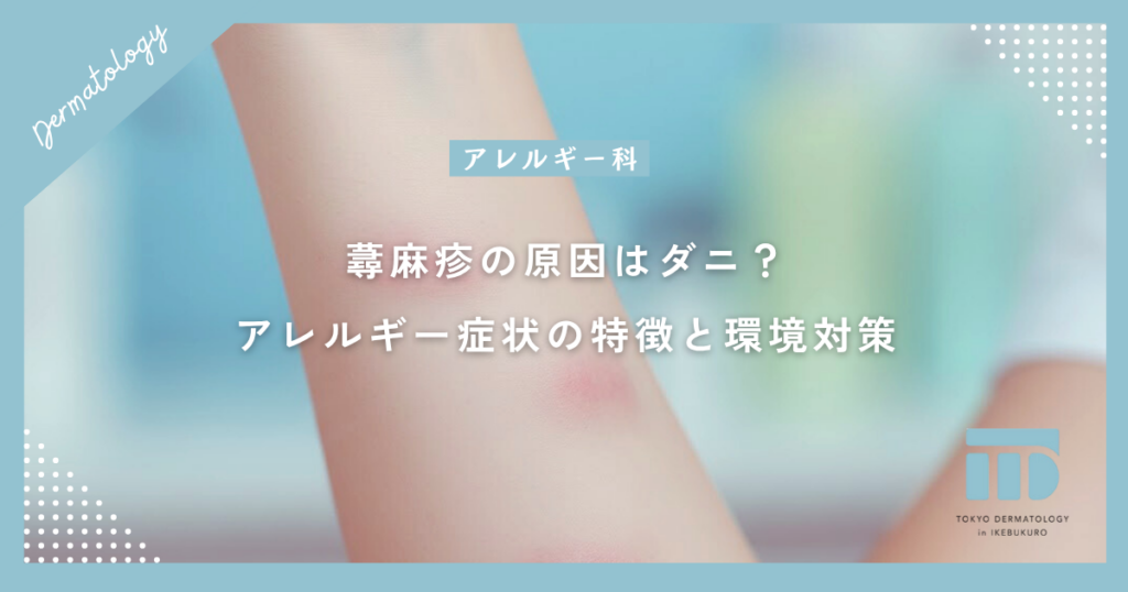 蕁麻疹の原因はダニ？ハウスダストによるアレルギー症状の特徴と環境対策