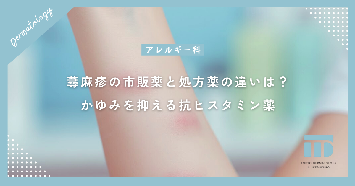 【蕁麻疹の薬】市販薬と処方薬の違いは？かゆみを抑える抗ヒスタミン薬