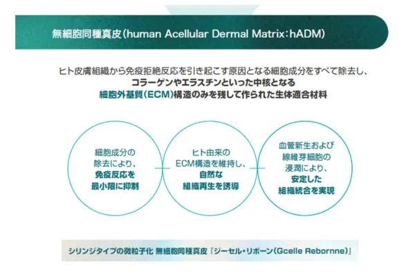 リボーンの作用機序（細胞成分の除去→ECM構造の維持→血管新生による組織統合）