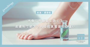 水虫に市販薬は効く？治らない原因と皮膚科で処方される抗真菌薬との違い