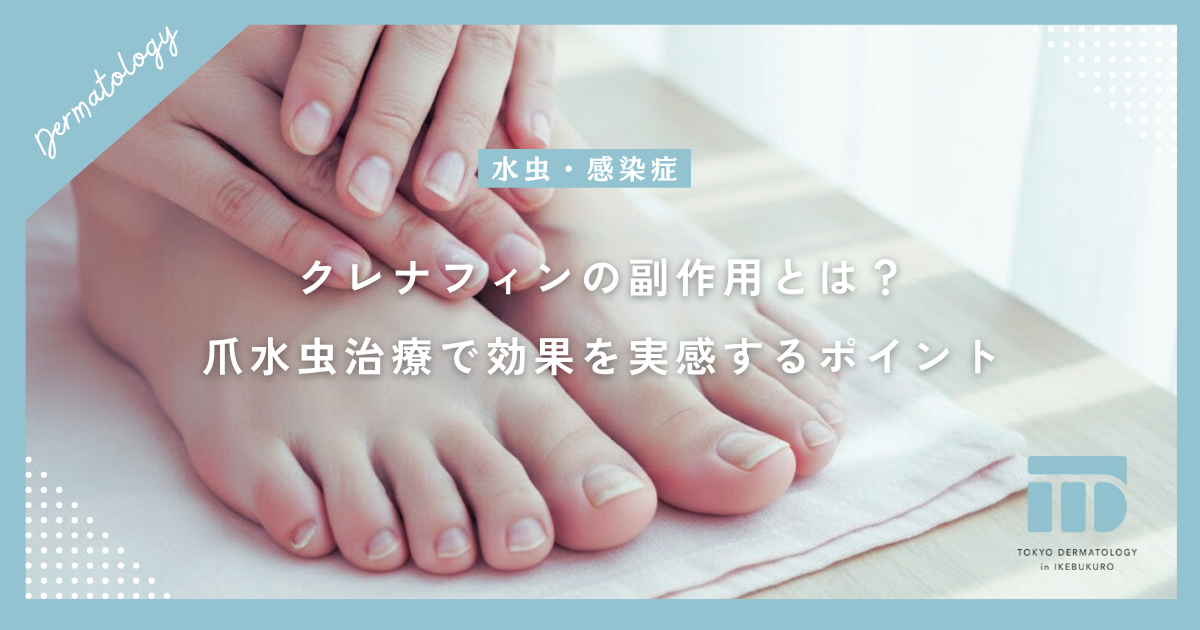 クレナフィンの副作用とは？爪水虫治療で効果を実感するためのポイント