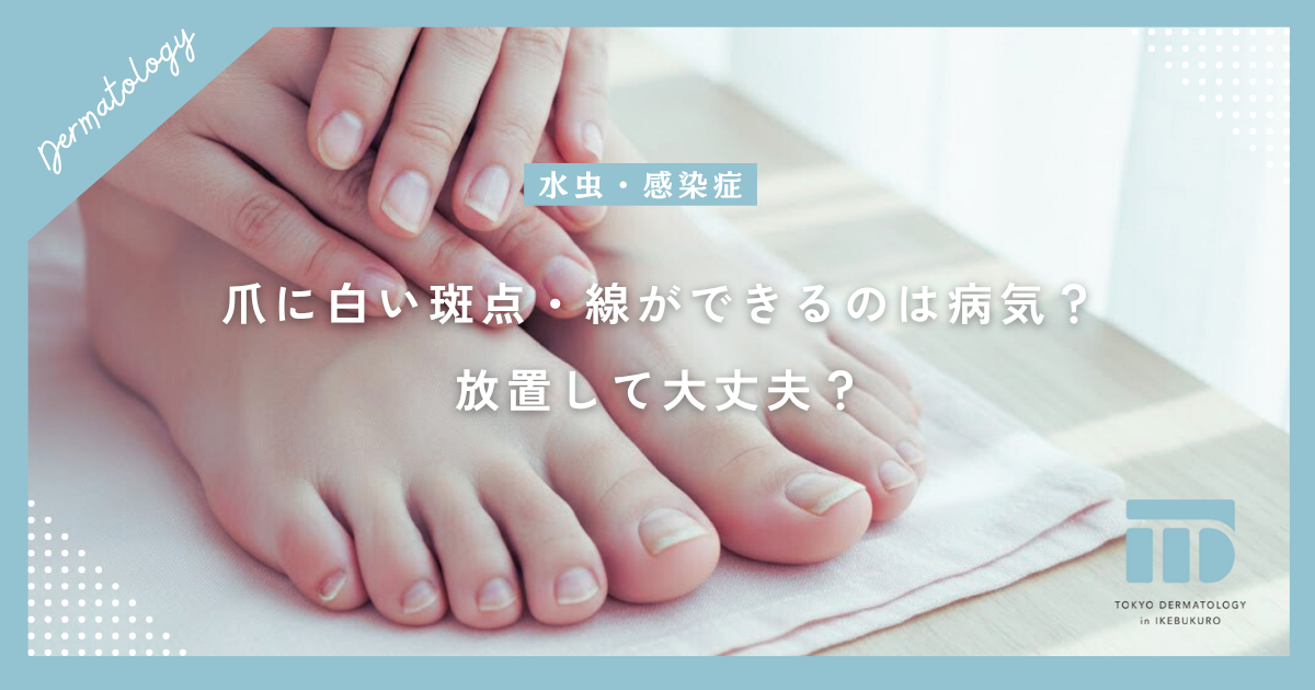 【爪甲白斑の原因】爪に白い斑点・線ができるのは病気?放置して大丈夫?