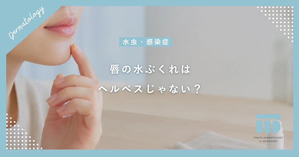 【唇の水ぶくれはヘルペスじゃない？】口角炎や接触皮膚炎との見分け方を解説