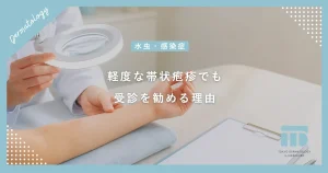 【軽度な帯状疱疹】水ぶくれや痛みが少ない場合も受診すべき理由と放置リスク