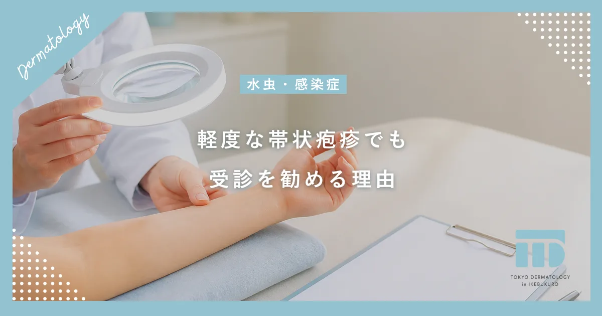 【軽度な帯状疱疹】水ぶくれや痛みが少ない場合も受診すべき理由と放置リスク