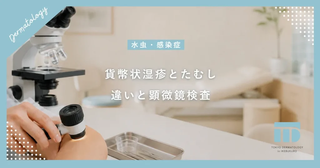 【貨幣状湿疹とたむしの違い】丸い赤みやかゆみの原因と皮膚科での顕微鏡検査
