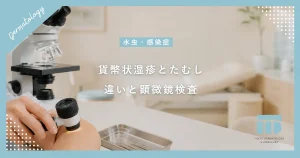 【貨幣状湿疹とたむしの違い】丸い赤みやかゆみの原因と皮膚科での顕微鏡検査