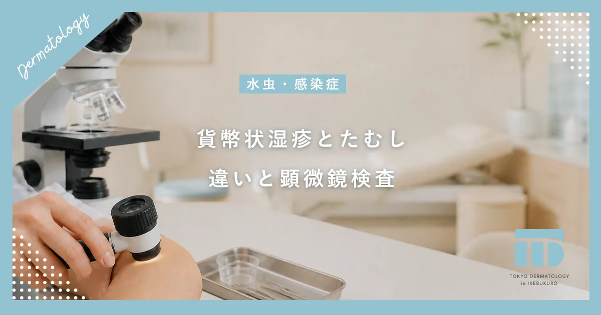 【貨幣状湿疹とたむしの違い】丸い赤みやかゆみの原因と皮膚科での顕微鏡検査