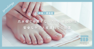 爪水虫で分厚くなった爪を削る方法は？安全なケアと皮膚科での専門的な処置