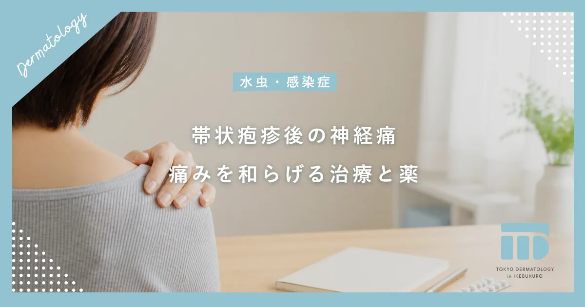 帯状疱疹後の神経痛がこれで消えた？長引く痛みを和らげる正しい治療法と薬