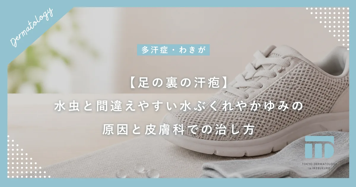 【足の裏の汗疱】水虫と間違えやすい水ぶくれやかゆみの原因と皮膚科での治し方
