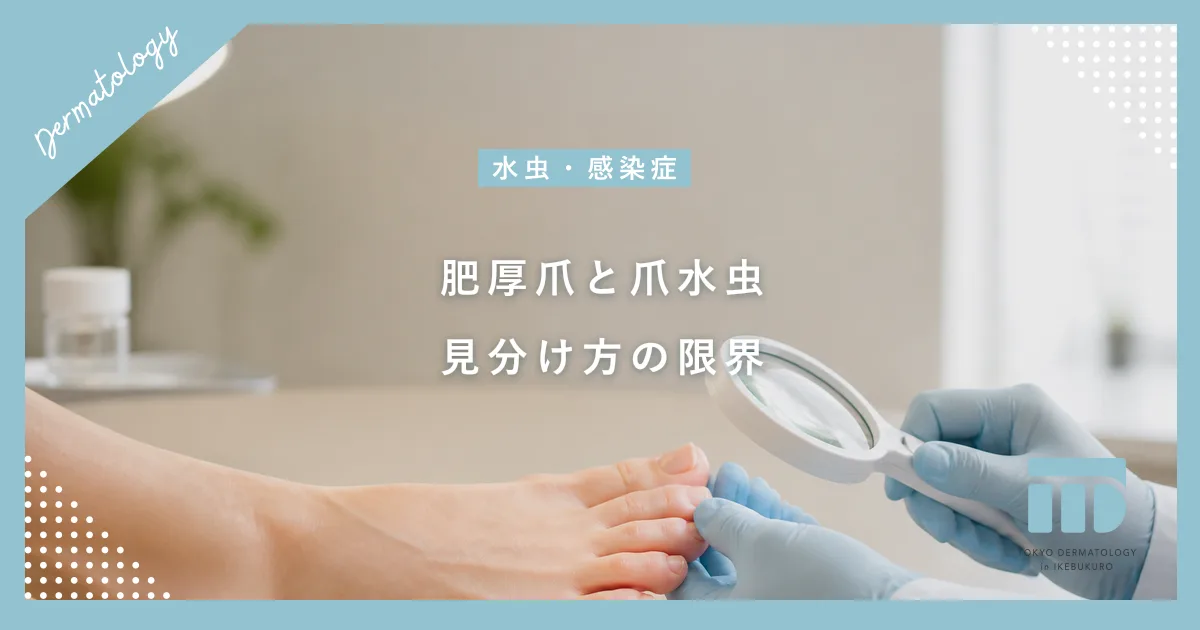 【肥厚爪と爪水虫の見分け方】分厚い爪の原因はカビか加齢か?自己判断の危険性