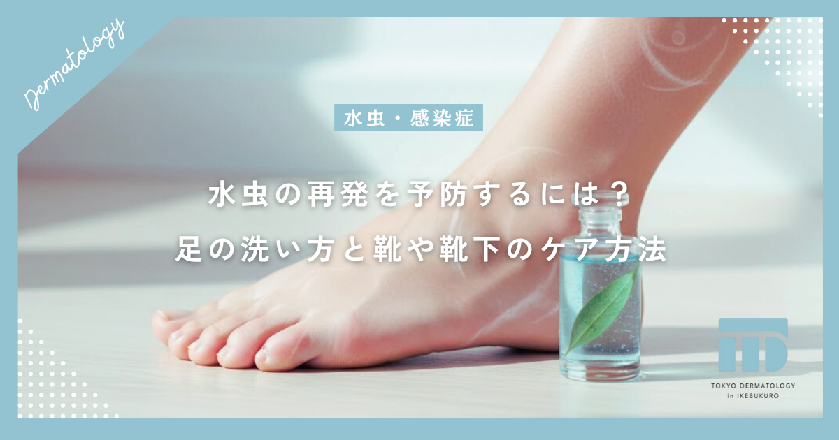 水虫の再発を予防するには?完治後の正しい足の洗い方と靴や靴下のケア方法