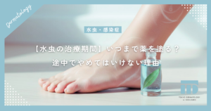 【水虫の治療期間】いつまで薬を塗る？かゆみが消えても途中でやめてはいけない理由